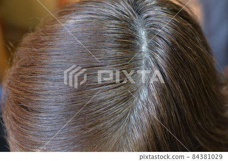 A woman who is worried about the white hair on her hairline A woman who is worried about the white hair on her hairline 84381029