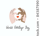 Swarthy hands with vitiligo make a heart shape gesture 84387990