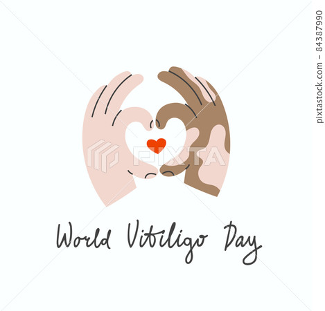 Swarthy hands with vitiligo make a heart shape gesture Swarthy hands with vitiligo make a heart shape gesture 84387990
