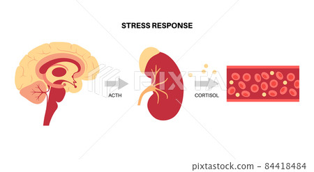 Stress responce system 84418484