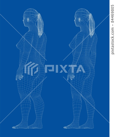 Fat and slim woman, before and after weight loss 84469805