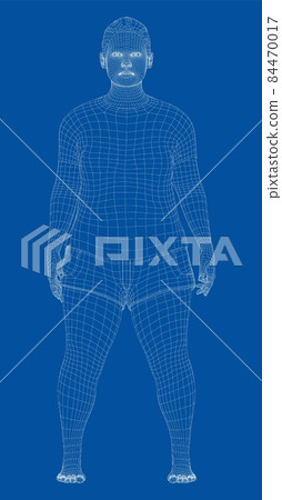 Fat woman, before weight loss 84470017