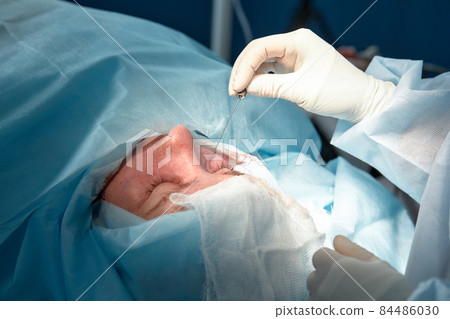 Close up of the face of a patient who is undergoing blepharoplasty. The surgeon cuts the eyelid and performs manipulations using medical instruments Close up of the face of a patient who is undergoing blepharoplasty. The surgeon cuts the eyelid and performs manipulations using medical instruments 84486030