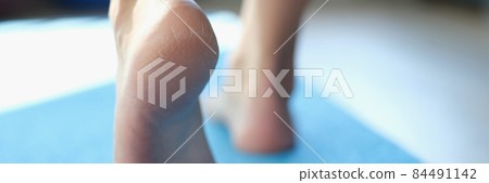 Women feet walking on sports mat with dry skin on heels closeup Women feet walking on sports mat with dry skin on heels closeup 84491142