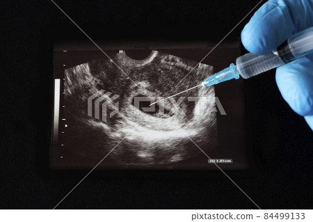 The doctor injects a shot into the uzi pregnancy, an abortion, a syringe, a glove, a black background 84499133