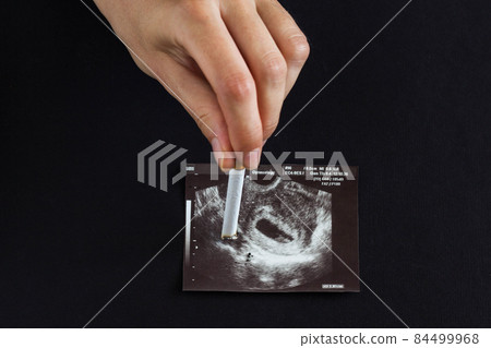A woman's hand, a future mother extinguishes a cigarette on a picture of a pregnancy uzi, pregnancy and smoking, cigarette and pregnancy 84499968