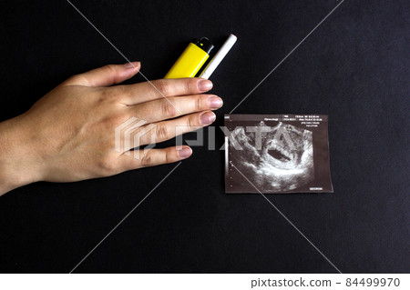 The future mother holds a cigarette and a lighter in her hand, next to a photograph of the pregnancy uzi, pregnancy and smoking, gestation The future mother holds a cigarette and a lighter in her hand, next to a photograph of the pregnancy uzi, pregnancy and smoking, gestation 84499970