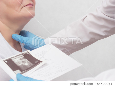 A woman is on reception at the endocrinologist, the doctor looks at the results of an ultrasound scan of the thyroid gland, close-up, medic A woman is on reception at the endocrinologist, the doctor looks at the results of an ultrasound scan of the thyroid gland, close-up, medic 84500054