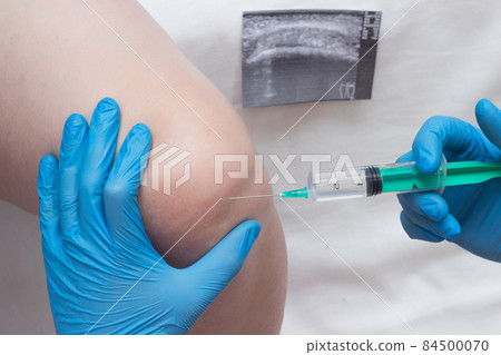 A doctor injects a medical injection of chondroprotector and hyaluronic acid into the knee of a woman to restore the knee joint, cartilage and synovial fluid, close-up 84500070