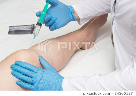 The doctor introduces the patient to an arthritic knee chondroprotector and the preparation of hilauri acid to restore the knee joint and synovial fluid, close-up 84500157