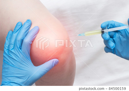 The doctor injects plasma into a sore, inflamed female knee for arthrosis and arthritis, plasma-lifting, close-up, medical, professional The doctor injects plasma into a sore, inflamed female knee for arthrosis and arthritis, plasma-lifting, close-up, medical, professional 84500159
