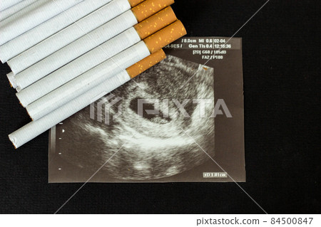 Cigarettes in the picture of pregnancy, pregnancy and smoking, cigarette 84500847