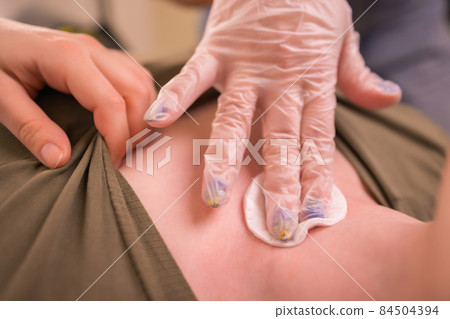 Operation to install microdermal piercing. Professional placing 84504394