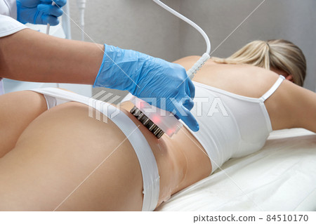 Hardware cosmetology. Body care. Spa treatment. Ultrasound cavitation body contouring treatment 84510170