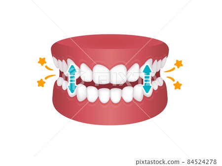 類型的磨牙症 (bruxism) 矢量圖/攻絲 84524278