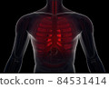 Infected human lungs 84531414