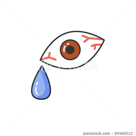 Symptom of Allergic Reaction, Bloodshot Human Eye Symptom of Allergic Reaction, Bloodshot Human Eye 84560522