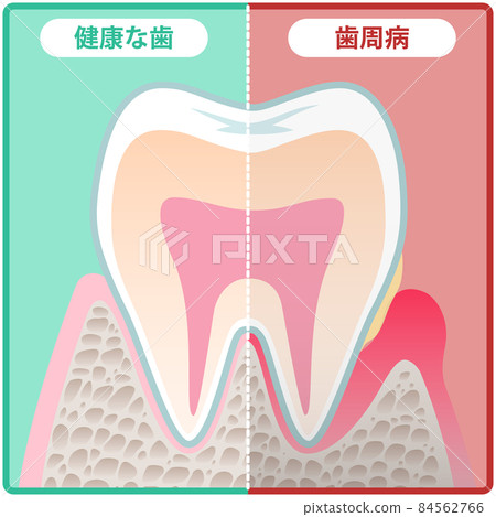 Tooth cross section Tooth cross section 84562766
