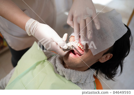 Dental treatment: Taking a mold with impression material 84649593