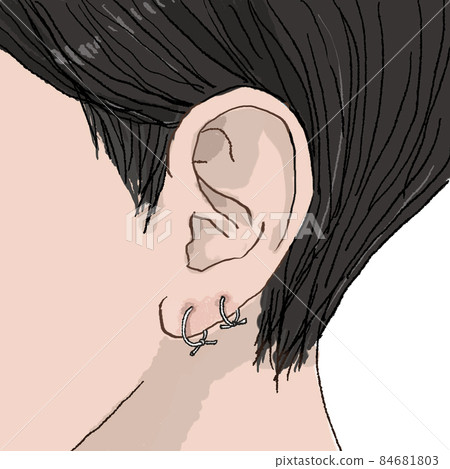 Ears, piercing troubles, ears being treated with silicone tube (piercing trouble 3) Ears, piercing troubles, ears being treated with silicone tube (piercing trouble 3) 84681803