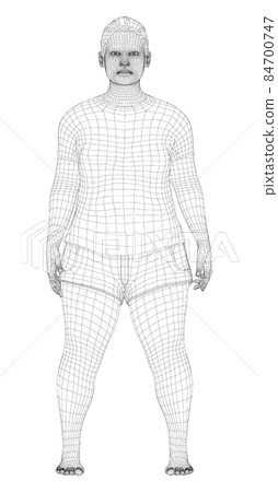 Fat woman, before weight loss 84700747