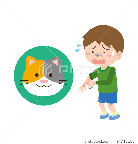 A boy with urticaria due to cat allergies A boy with urticaria due to cat allergies 84713193