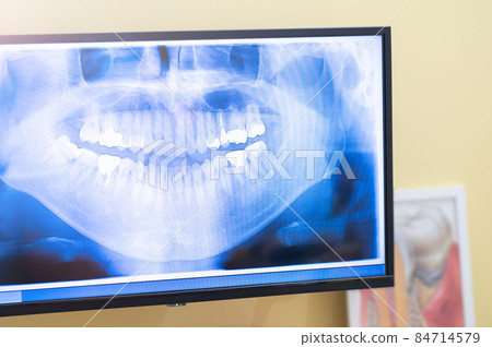Image of digital X-ray of dental clinic 84714579