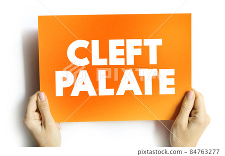 Cleft palate text quote on card, concept background Cleft palate text quote on card, concept background 84763277