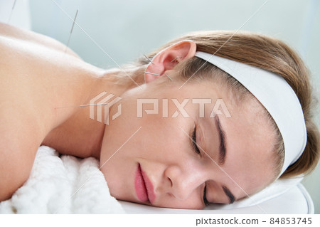 Beautiful woman relaxing on a bed having acupuncture treatment with needles in and around her ear. Alternative Therapy concept Beautiful woman relaxing on a bed having acupuncture treatment with needles in and around her ear. Alternative Therapy concept 84853745