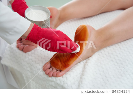 Doctor preparing to make injections of botulinum toxinon in female feet against hyperhidrosis, excessive sweating 84854134
