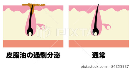 毛孔 毛孔 84855587