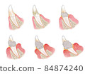 Illustration of dog teeth Illustration of dog periodontal disease 84874240