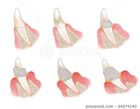 Illustration of dog teeth Illustration of dog periodontal disease 84874240