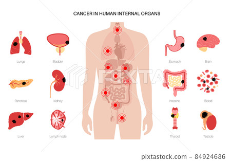 Cancer icons set 84924686