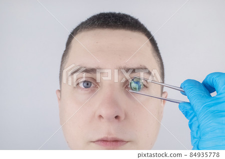 Conceptual shot of an eye crystalline lens replacement. Ophthalmic surgery. Return of sight. Removal of cataracts. Surgical intervention in the eyeball. Doctor holds the implant near the patient Conceptual shot of an eye crystalline lens replacement. Ophthalmic surgery. Return of sight. Removal of cataracts. Surgical intervention in the eyeball. Doctor holds the implant near the patient 84935778