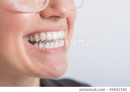 Close-up of a woman putting on transparent plastic retainers. The girl uses a device to straighten her teeth Close-up of a woman putting on transparent plastic retainers. The girl uses a device to straighten her teeth 84942588