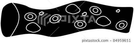 Blood vessel silhouette material 84959651
