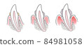 Structural illustration of teeth explaining the progression of periodontal disease in dogs 84981058
