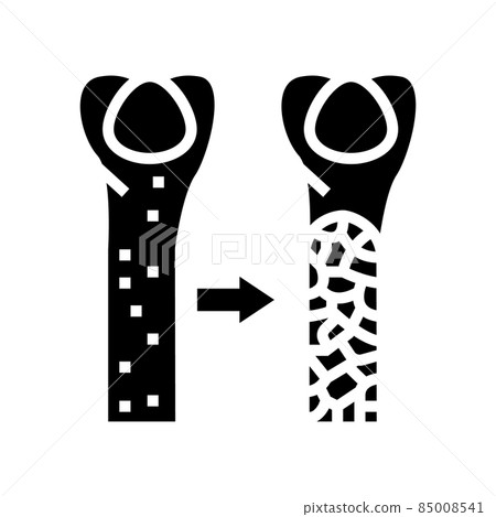 osteoporosis bone disease glyph icon vector illustration osteoporosis bone disease glyph icon vector illustration 85008541