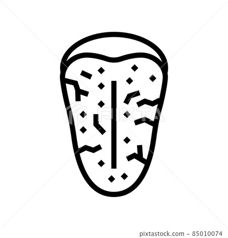 sjogrens syndrome line icon vector illustration sjogrens syndrome line icon vector illustration 85010074