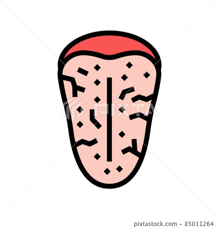 sjogrens syndrome color icon vector illustration sjogrens syndrome color icon vector illustration 85011264