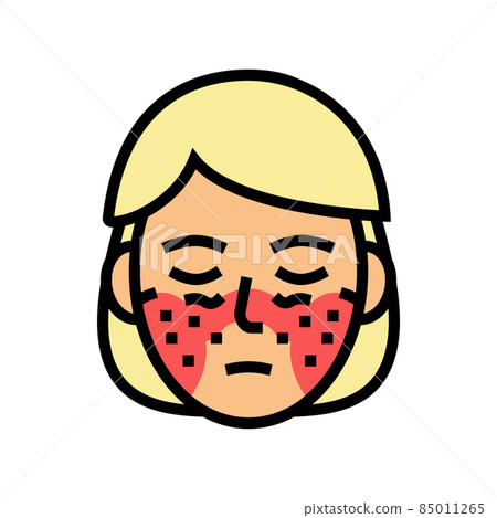systemic lupus erythematosus color icon vector illustration systemic lupus erythematosus color icon vector illustration 85011265