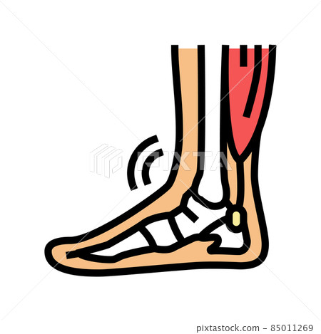 tendonitis problem color icon vector illustration tendonitis problem color icon vector illustration 85011269