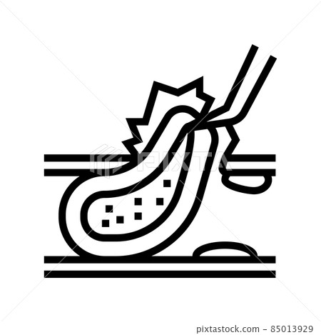 carotid endarterectomy line icon vector illustration carotid endarterectomy line icon vector illustration 85013929