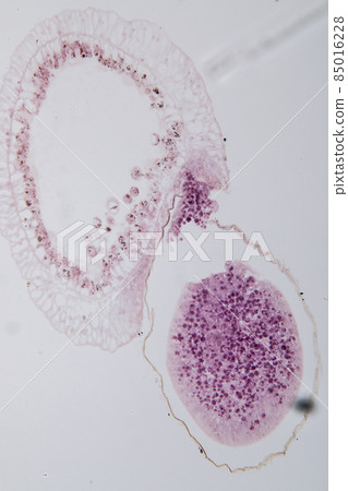 Hydra is a genus of small, fresh-water animals of the phylum Cnidaria and class Hydrozoa under the microscope for education. 85016228