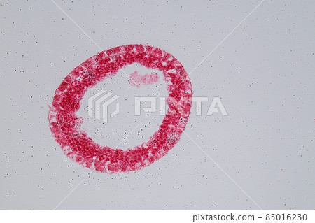 Hydra is a genus of small, fresh-water animals of the phylum Cnidaria and class Hydrozoa under the microscope for education. Hydra is a genus of small, fresh-water animals of the phylum Cnidaria and class Hydrozoa under the microscope for education. 85016230