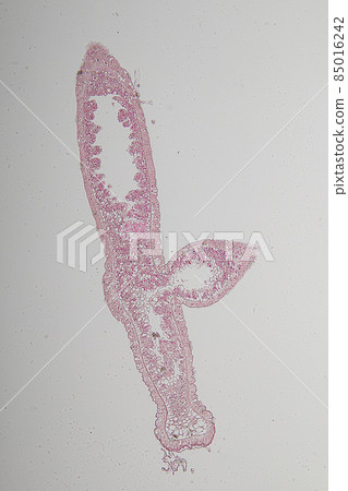 Hydra is a genus of small, fresh-water animals of the phylum Cnidaria and class Hydrozoa under the microscope for education. 85016242