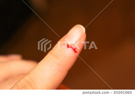 Blood protrudes from a small cut wound, maim on the index finger of a woman's hand. Damage to epidermis, skin on body. Bleeding injured fingers, hands palm. An accidence, life insurance. Feel pain. Blood protrudes from a small cut wound, maim on the index finger of a woman's hand. Damage to epidermis, skin on body. Bleeding injured fingers, hands palm. An accidence, life insurance. Feel pain. 85091060