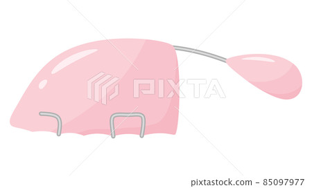 唇裂和腭裂_Palatallift示意圖_軟齶提升器 85097977