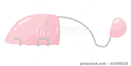 Cleft lip and palate_Illustration of valve-type speech aid_Dysarthria 85098026